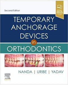 Temporary Anchorage Devices in Orthodontics, 2nd Edition