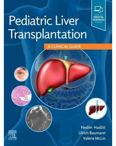 Pediatric Liver Transplantation