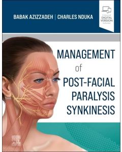 Management of Post-Facial Paralysis Synkinesis