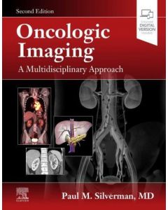 Oncologic Imaging: A Multidisciplinary Approach, 2nd Edition