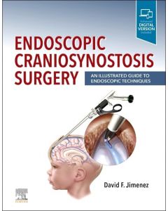 Endoscopic Craniosynostosis Surgery An Illustrated Guide to Endoscopic Techniques