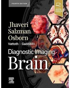 Diagnostic Imaging: Brain, 4th Edition