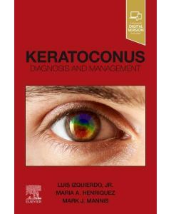 Keratoconus. Diagnosis and Management