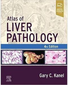 Atlas of Liver Pathology, 4th Edition