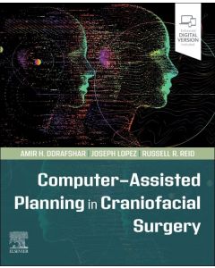 Computer-Assisted Planning in Craniofacial Surgery