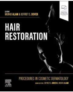 Procedures in Cosmetic Dermatology: Hair Restoration