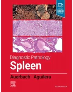 Diagnostic Pathology: Spleen, 2nd Edition