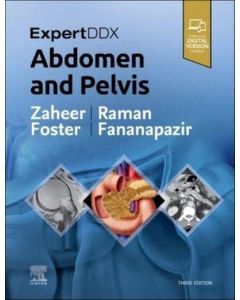 ExpertDDx: Abdomen and Pelvis, 3rd Edition