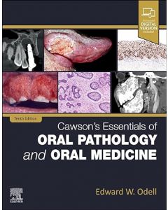 Cawson's Essentials of Oral Pathology and Oral Medicine, 10th Edition