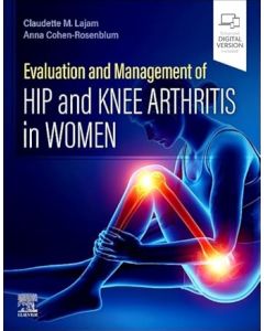 Evaluation and Management of Hip and Knee Arthritis in Women