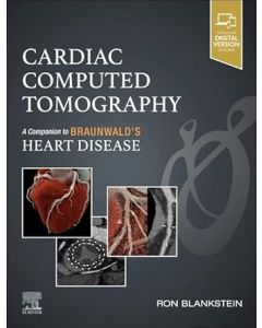 Cardiac Computed Tomography