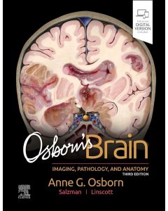 Osborn's Brain, 3rd Edition