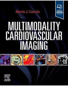 Multimodality Cardiovascular Imaging