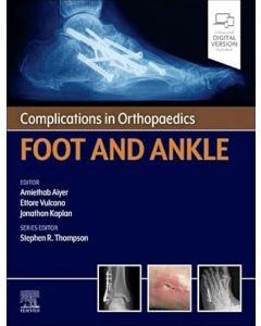 Complications in Orthopaedics: Foot and Ankle