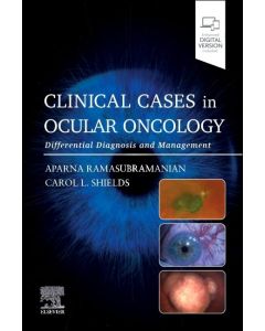 Clinical Cases in Ocular Oncology Differential Diagnosis and Management