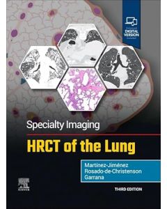Specialty Imaging: HRCT of the Lung, 3rd Edition