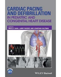 Cardiac Pacing and Defibrillation in Pediatric and Congenital Heart Disease