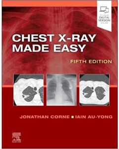 Chest X-Ray Made Easy, 5th Edition