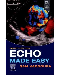Echo Made Easy, 4th Edition