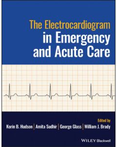Electrocardiogram in Emergency Acute Care