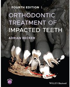 Orthodontic Treatment of Impacted Teeth, 4th Edition