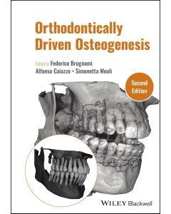 Orthodontically Driven Osteogenesis, 2nd Edition