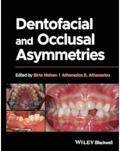 Dentofacial and Occlusal Asymmetries