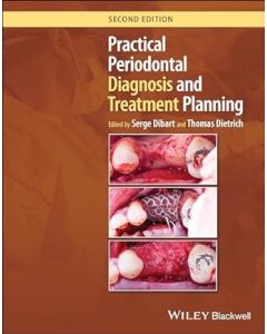 Practical Periodontal Diagnosis and Treatment Planning, 2nd Edition
