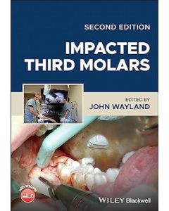 Impacted Third Molars, 2nd Edition