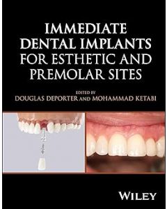 Immediate Dental Implants for Esthetic and Premolar Sites
