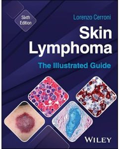 Skin Lymphoma: The Illustrated Guide, 6th Edition