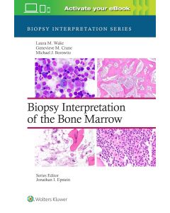 Biopsy Interpretation of the Bone Marrow