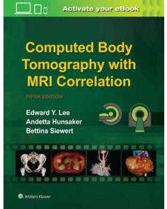Computed Body Tomography with MRI Correlation 5th