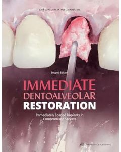 Immediate Dentoalvelolar Restoration. Immediately Loaded Implants in Compromised Sockets