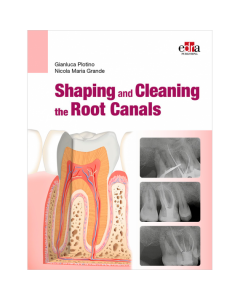 Shaping and Cleaning the Root Canals