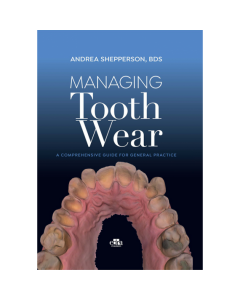 Managing Tooth Wear. A Comprehensive Guide for General Practice