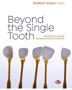 Beyond the Single Tooth. Treatment planning for whole mouth dentistry