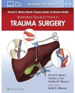 Ernest E. Moore Shock Trauma Center at Denver Health Illustrated Tips and Tricks in Trauma Surgery