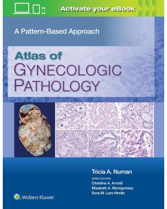 Atlas of Gynecologic Pathology A Pattern-Based Approach