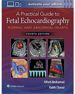 A Practical Guide to Fetal Echocardiography Normal and Abnormal Hearts, 4th edition