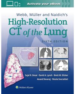 Webb, Müller and Naidich's High-Resolution CT of the Lung 6th edition
