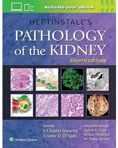 Heptinstall's Pathology of the Kidney 8th edition