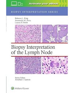  Biopsy Interpretation of the Lymph Node