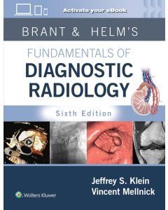 Brant & Helm's Fundamentals of Diagnostic Radiology: Print + eBook with Multimedia 6th edition