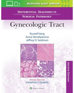 Differential Diagnoses in Surgical Pathology: Gynecologic Tract 2nd edition