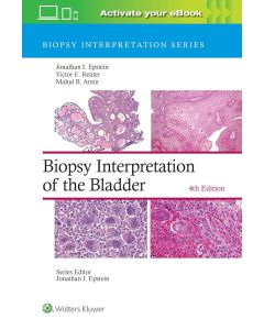 Biopsy Interpretation of the Bladder 4th edition