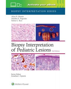 Biopsy Interpretation of Pediatric Lesions  2nd edition