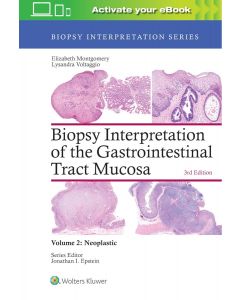 Biopsy Interpretation of the Gastrointestinal Tract Mucosa Volume 2 Neoplastic