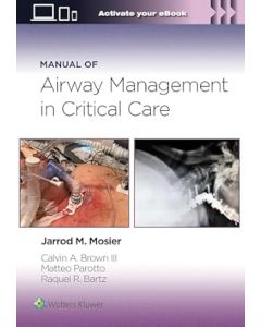 Manual of Airway Management in Critical Care