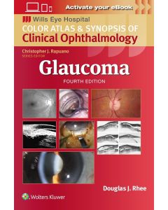 Glaucoma 4th edition